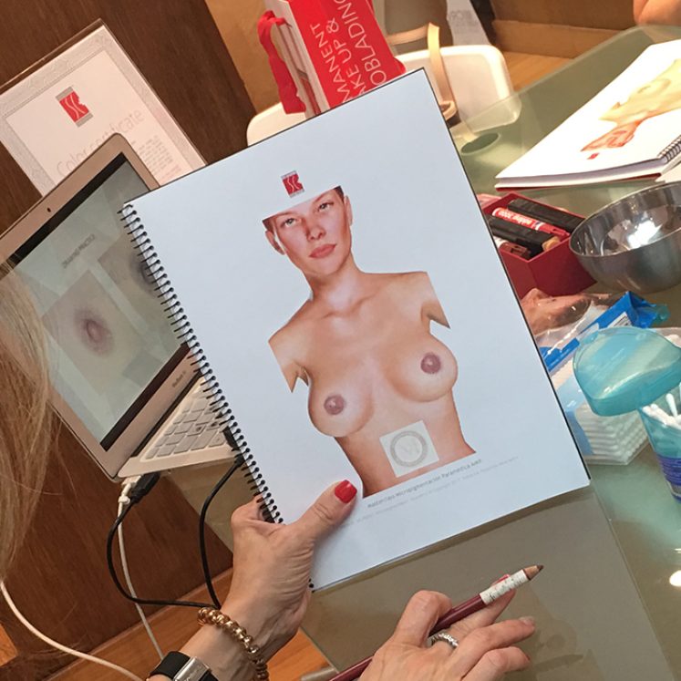 areolas